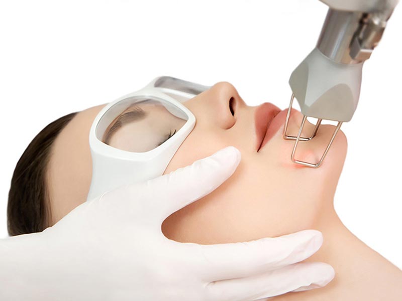 Điều trị da bằng công nghệ laser
