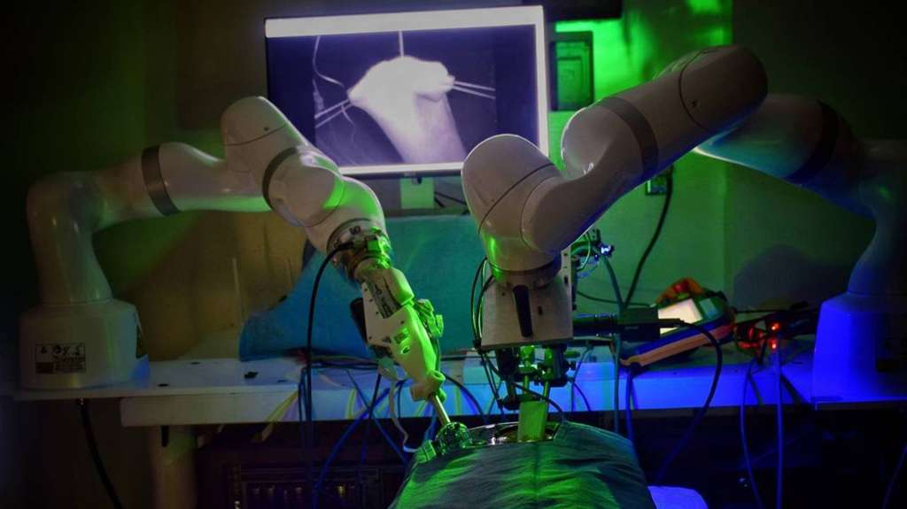 Advanced robotic surgery system in operation