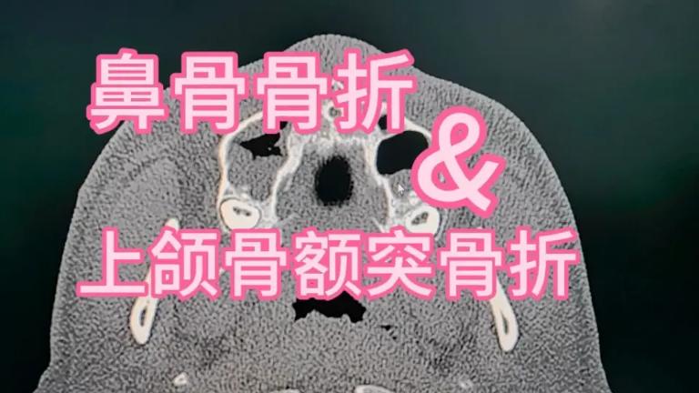 鼻子的结构第4张