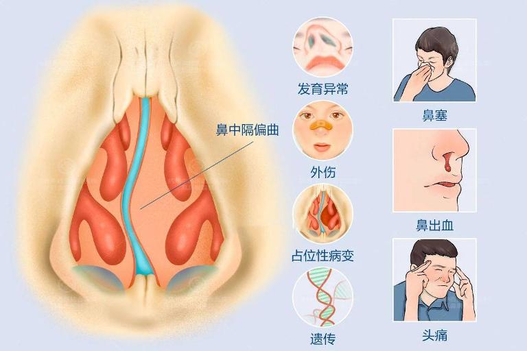 鼻子的结构第2张